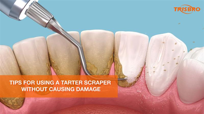 Tips for Using a Tarter Scraper Without Causing Damage